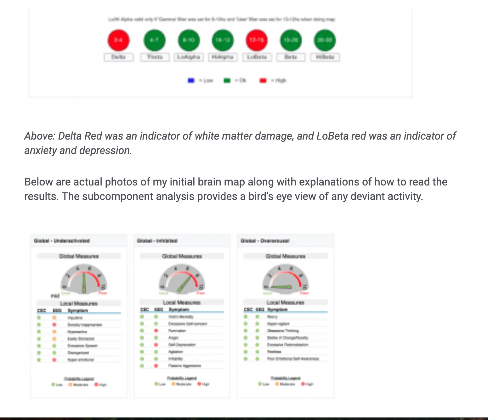qEEG brain wave band map — Delta, Theta, LoAlpha, HiAlpha, LoBeta, Beta, HiBeta — with red flags indicating over-activity